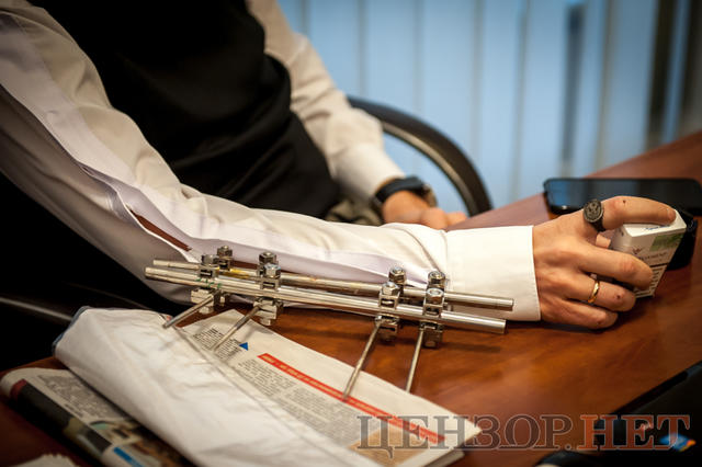 Ігор Мосійчук: Футбольні ставки Ляшка? Це тоталізатор. Він ставить на Шахтар, я ставлю на Динамо. Була нічия - програли і він, і я. Що ж робити? 09 Ігор Мосійчук: Футбольні ставки Ляшка? Це тоталізатор. Він ставить на Шахтар, я ставлю на Динамо. Була нічия - програли і він, і я. Що ж робити? 09