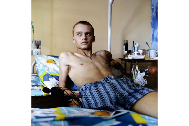 Проект українського фотографа Чекменьова зі знімками поранених воїнів зібрав близько $ 400000 для їх лікування і підтримки 23