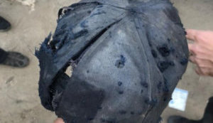 Поліція вмовила ветерана в Кривому Розі віддати одну гранату, через підрив іншої постраждав він і троє патрульних, - Недря. ФОТО