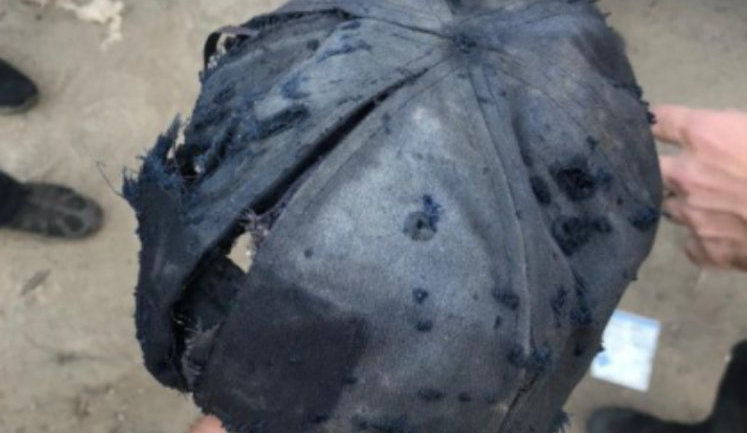 Поліція вмовила ветерана в Кривому Розі віддати одну гранату, через підрив іншої постраждав він і троє патрульних, - Недря. ФОТО