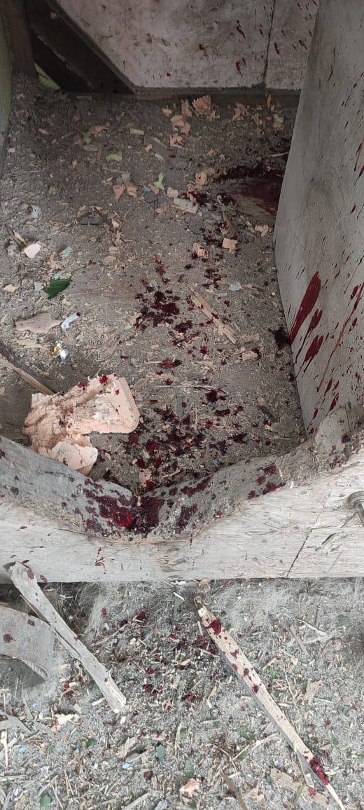 Enemy hit suburbs of Kherson again, 3 people were wounded 05