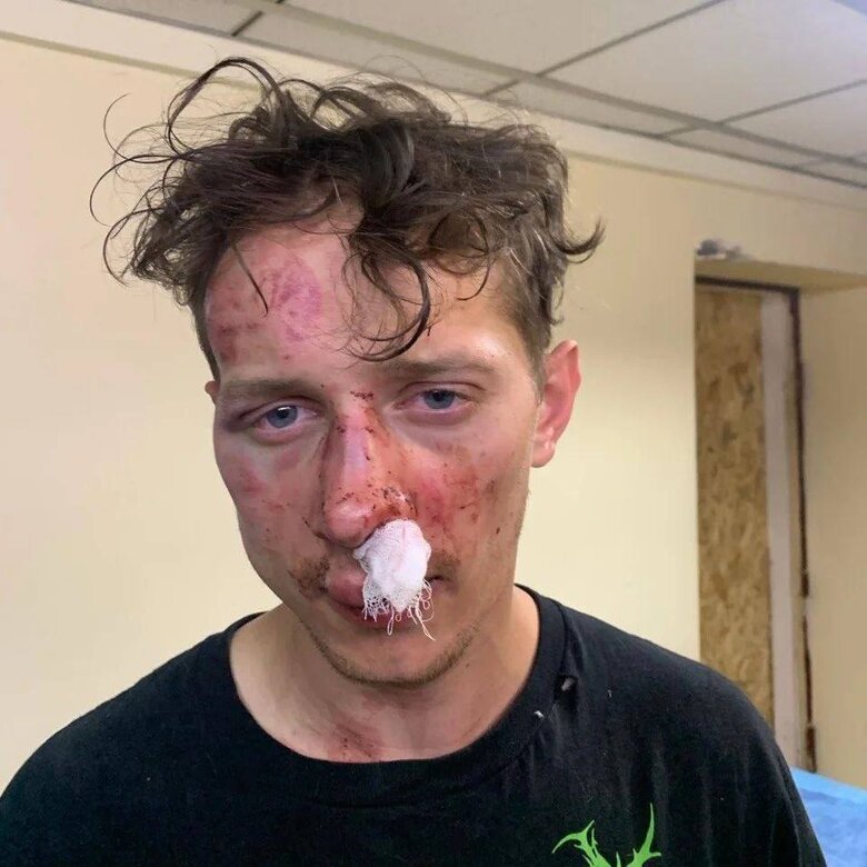 У Києві побили ветерана