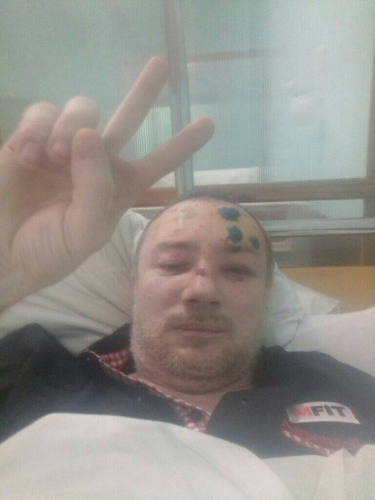 Розвідник 47-ї бригади Сергій Назаренко про контрнаступ на півдні: Я зразу попереджав усіх своїх підлеглих: Перше, що ви втратите, це ілюзії 03