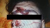 Унаслідок вибуху у квартирі в Голосіївському районі загинув Луан Кінгісепп (Лука), розшукуваний у справі про вбивство водія BlaBlaCar Познякова. ФОТО 18+