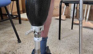 Протез кінцівки краще робити в Україні.