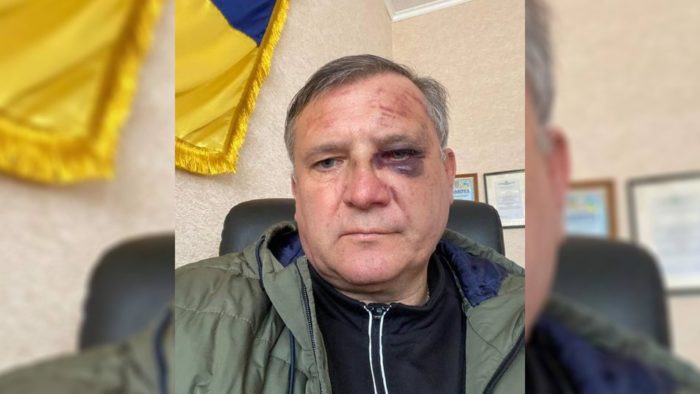 Окупанти 1,5 доби тримали в полоні старосту округу на Чернігівщині. Над чоловіком знущались, щоб отримати дані про розташування ЗСУ 01