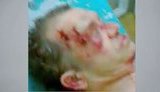 Human Rights Activist who Helped Villagers in Land Wars Brutally Murdered. Police Says He Slipped and Fell. VIDEO