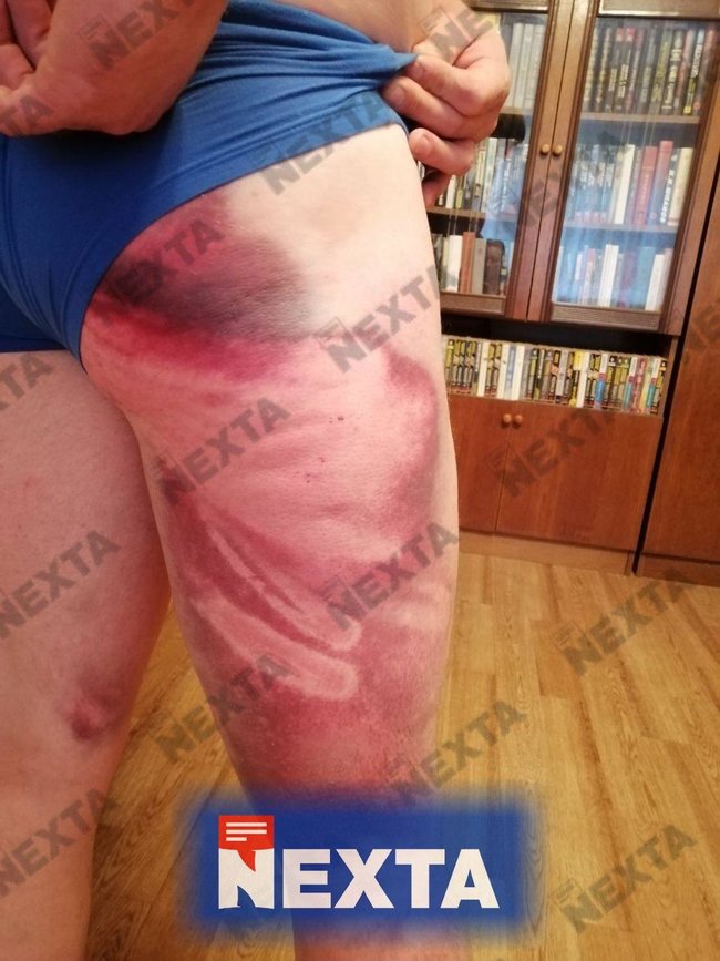 Зверства белорусского ОМОНа: жуткие кадры пыток задержанных 03