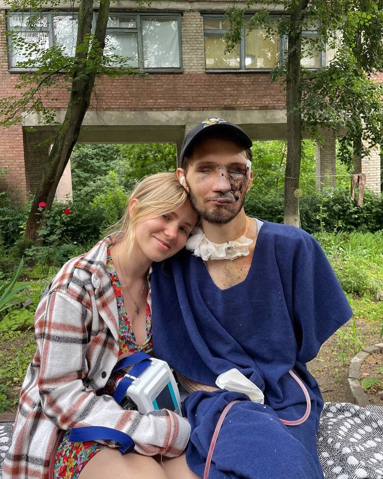 Воїну Андрію Смоленському, який втратив обидва ока та частково руки під час бойового завдання, потрібна допомога у реабілітації 01