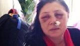 Учитель Ірина Рабченюк: "Підбіг спецпризначенець - весь у чорному і в блискучому шоломі - рубонув мене по обличчю. Я впала! Чула, як син кричав:"Ти ударив мою маму!"
