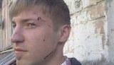 В центре Киева шестеро неизвестных избили журналиста. ФОТОрепортаж