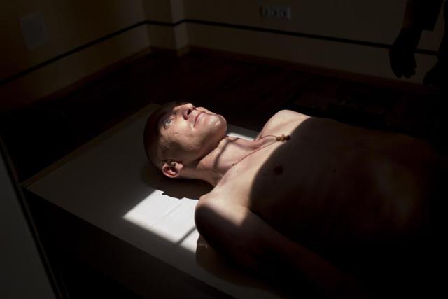 ato wounded