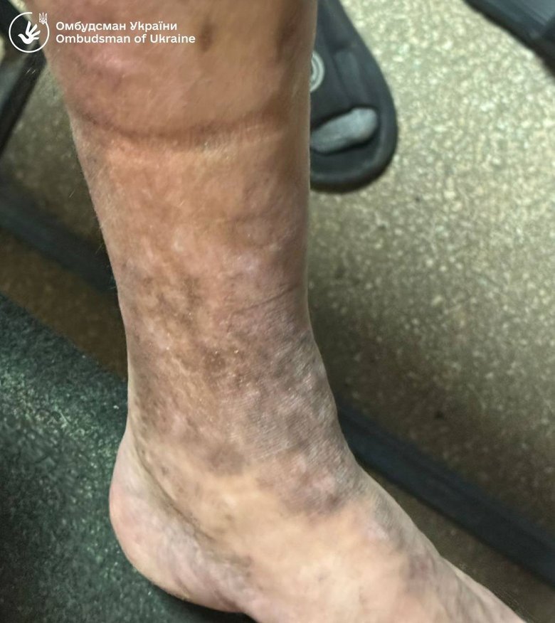 тцк порушення