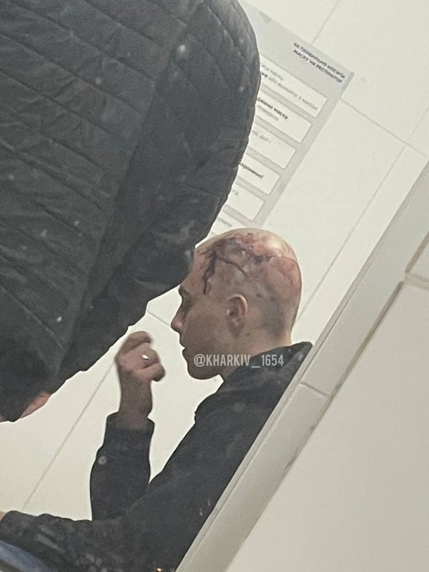 Смертельное ДТП в Харькове: в сети появилось фото 16-летнего парня, который был за рулем Infinitі 02 Смертельное ДТП в Харькове: в сети появилось фото 16-летнего парня, который был за рулем Infinitі 02