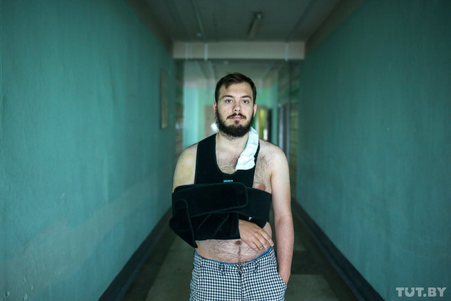 Побиті ОМОНом білоруси в лікарнях. Шокуючі 08