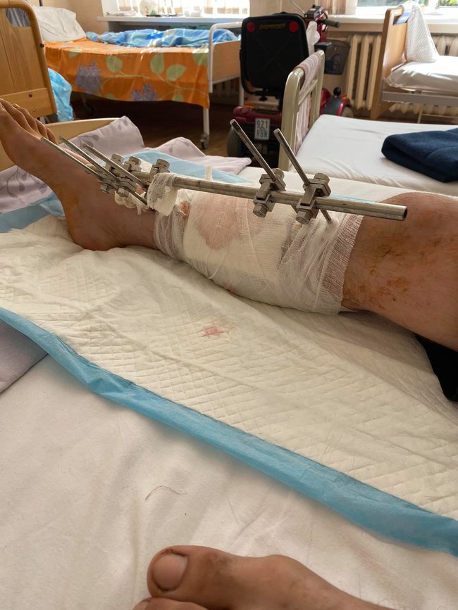 В киевский госпиталь доставили тяжелораненых воинов. Нужно много лекарств и обезболивающих, - волонтер Юсупова 05