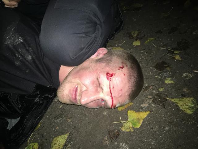 Police officer wounded while detaining robbers in Kropyvnytskyi 02 Police officer wounded while detaining robbers in Kropyvnytskyi 02