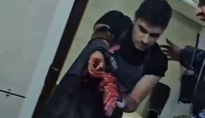 Співробітник заводу "Кремній Ел" у Брянську несе рештки своєї руки під час евакуації після атаки українських ракет. ВIДЕО 18+