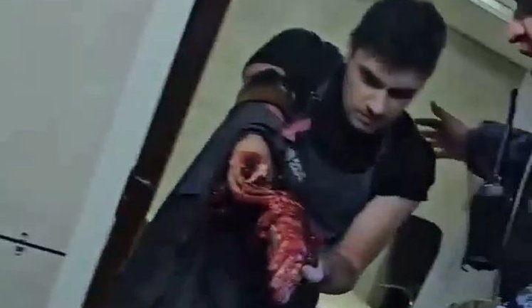 Співробітник заводу "Кремній Ел" у Брянську несе рештки своєї руки під час евакуації після атаки українських ракет. ВIДЕО 18+