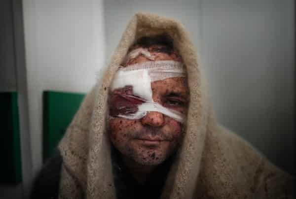 Українець Малолєтка став найкращим фотографом року за версією The Guardian 15