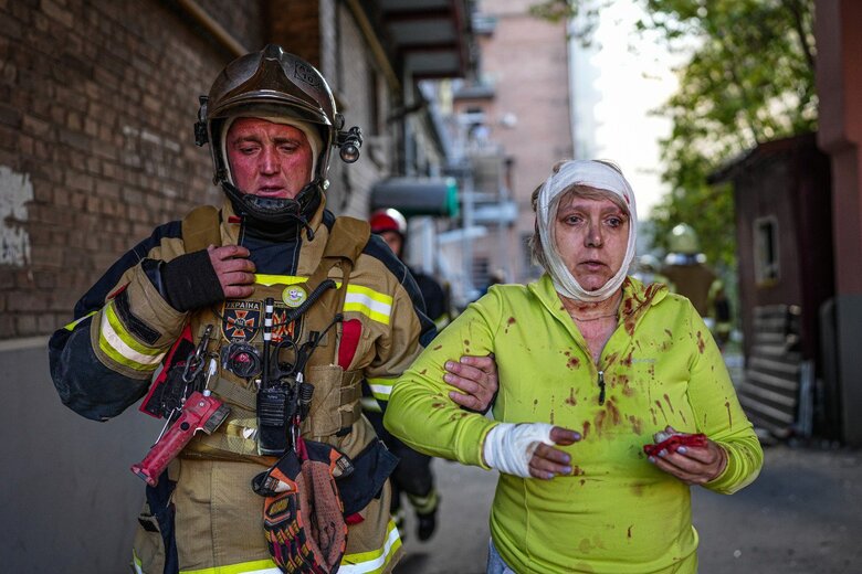 As result of morning rocket attacks, at least 9 people died. Another 36 were injured, - State Emergency Service 02