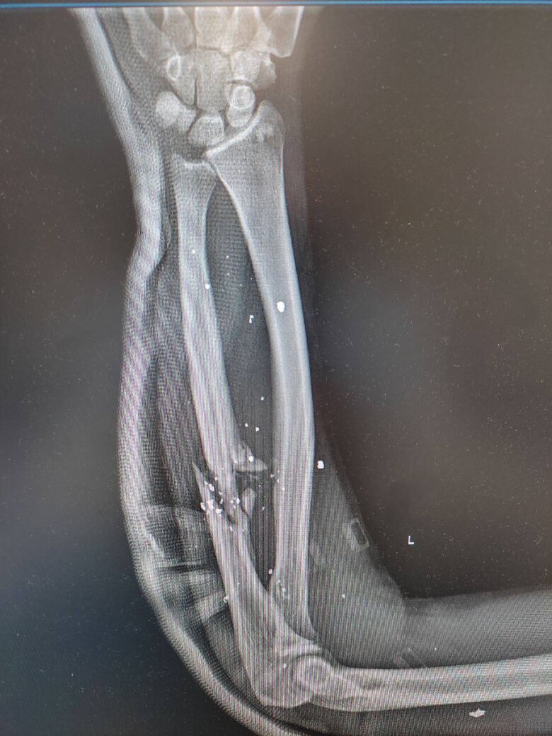 Командир на позивний Фантом: Треба зробити все, щоб навіть діти в садочку розуміли, що росія – ворог. Не дай Бог, щоб через два покоління ми відновили братські стосунки! 07 Командир на позивний Фантом: Треба зробити все, щоб навіть діти в садочку розуміли, що росія – ворог. Не дай Бог, щоб через два покоління ми відновили братські стосунки! 07