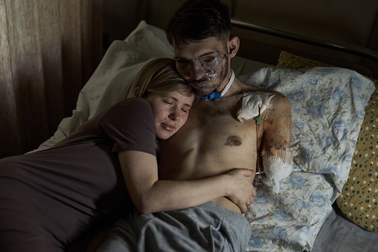 Wife in hospital hugs her husband, soldier of 47th brigade Andrii, who lost his hands and sight in battle against invaders 01