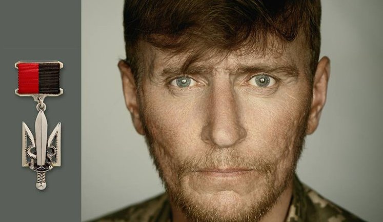 Бойцу батальона "Айдар" Руслану Корнутичу, после 6 ранений и 4 контузий, нужна помощь для реабилитации. ФОТО