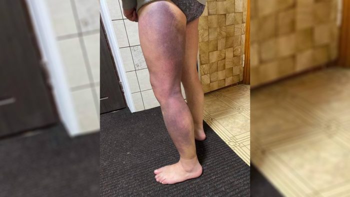 Окупанти 1,5 доби тримали в полоні старосту округу на Чернігівщині. Над чоловіком знущались, щоб отримати дані про розташування ЗСУ 02