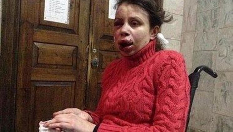 Ночью зверски избили журналистку Татьяну Чорновол. Шокирующие ФОТО + ВИДЕО