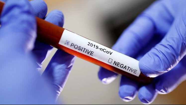 В Украине за сутки выявлено 16 новых случаев инфицирования коронавирусом, - ЦОЗ Минздрава (обновлено)