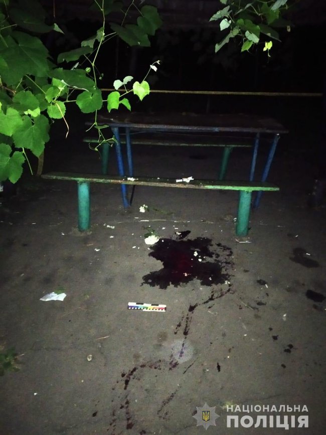 25-річний чоловік загинув через вибух гранати в Жовтих Водах, - поліція 01