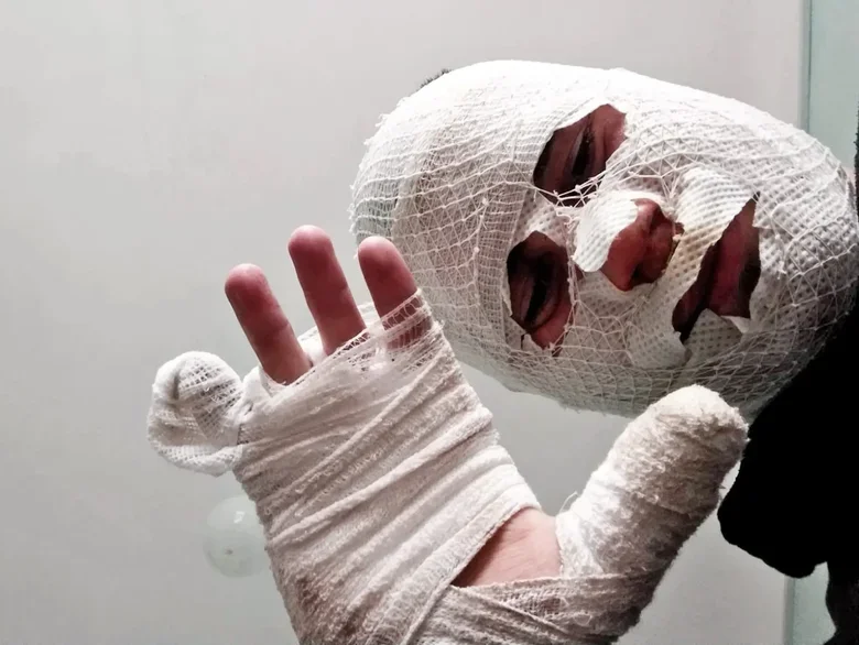 Операции ВСУ