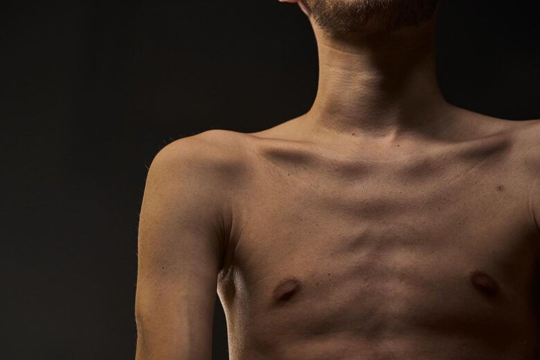 Author of photos from Azovstal Dmytro Orest Kozatsky talked about life after liberation from captivity 04