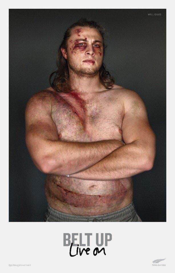 Пристегивайся. Живи: в Новой Зеландии выжившие в ДТП рассказали о пользе ремня безопасности 01