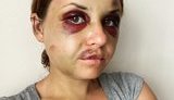 Жертва нападу в поїзді Анастасія Лугова: Схема дій у цієї істоти була налагоджена, але мене врятував син