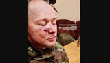 хливнюк