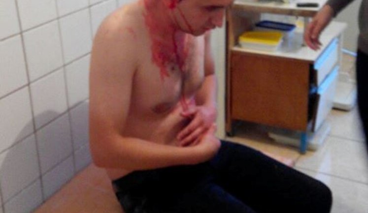 Journalist who fought against criminal mining of amber was severely beaten. PHOTO
