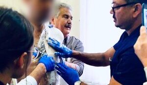 Троє американських протезистів та ерготерапевт допомагатимуть українцям зі складними ампутаціями верхніх кінцівок