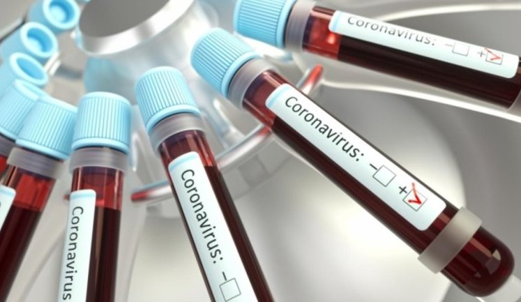 В Запорожской области выявили COVID-19 у 13 человек, в том числе у главы облсовета Самардака