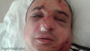 Well-known separatist Klinchaiev attacked in Kyiv. PHOTO