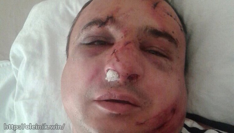 Well-known separatist Klinchaiev attacked in Kyiv. PHOTO