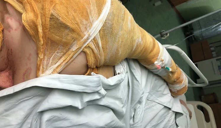 Handziuk identifies her attacker: "I’ve recognized the person. All detained suspects involved without a doubt"