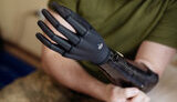 Esper Bionics