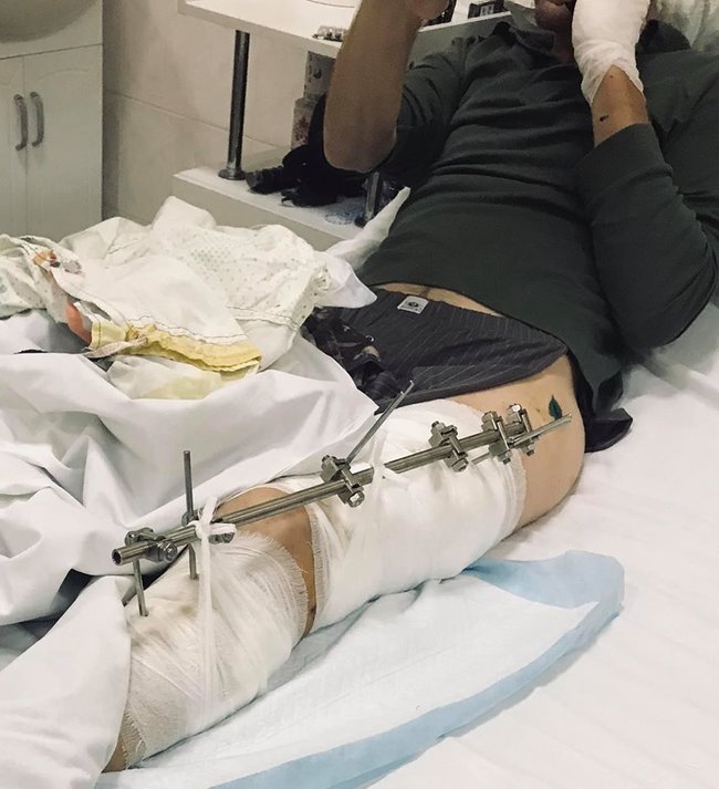 Завдяки допомозі громадян Київському військовому госпіталю купили апарат для відкачування гною, витратні матеріали та ліки 01 Завдяки допомозі громадян Київському військовому госпіталю купили апарат для відкачування гною, витратні матеріали та ліки 01