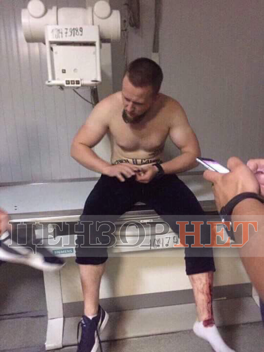 Стрілянина в Дніпрі: вбито учасників АТО Олексія Вагнера й Максима Іващука, поранено Едмонда Саакяна, чотирьох нападників поранили й затримали 03