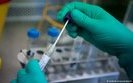 Suspected novel coronavirus cases not confirmed in Kyiv – Health Ministry