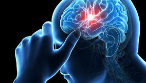 С 2020 года в Украине начнут создавать современные инсультные центры, - Супрун