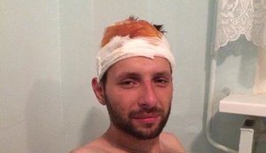 Парасюк перехитрил террористов, сотрудников ГРУ РФ и вырвался из плена, - Филатов. ФОТО