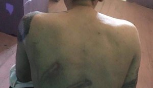побои